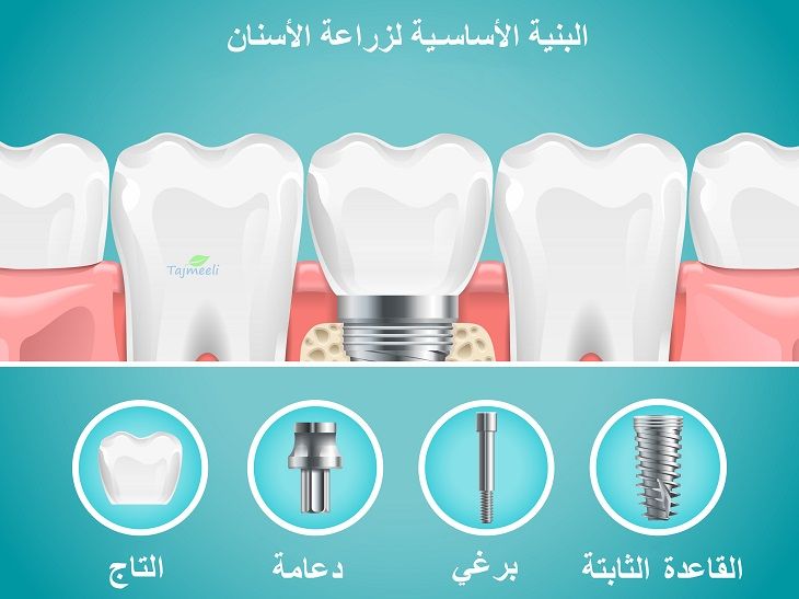 البنية الأساسية لزراعة الأسنان في تركيا