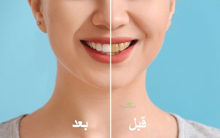  تقنية 3n للأسنان في السعودية