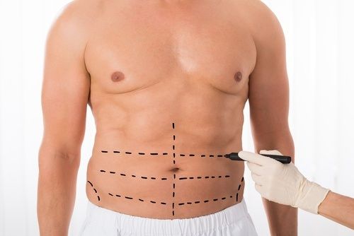 طريقة إجراء عملية Six Pack