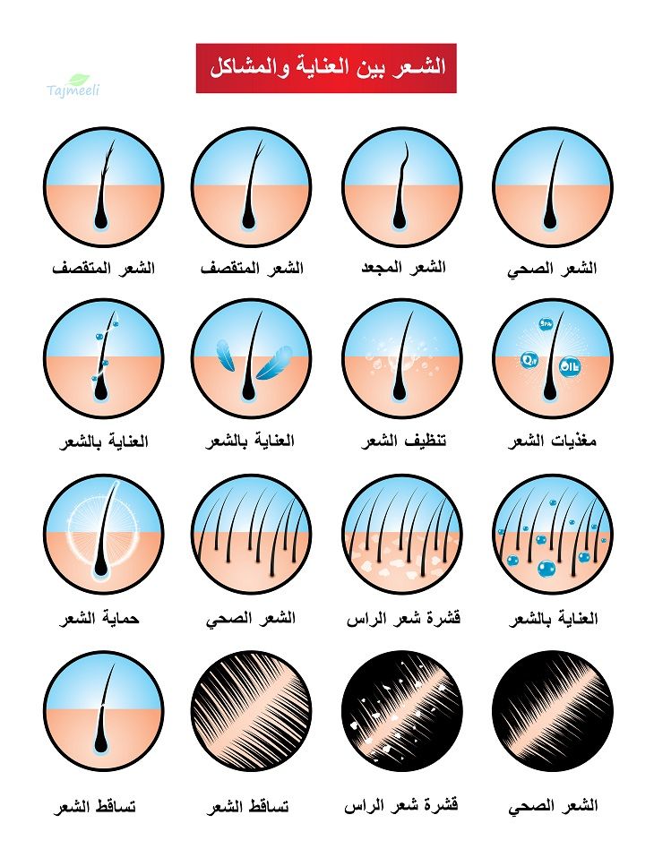 الشعر بين العناية والمشاكل