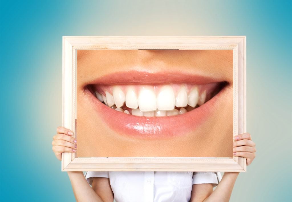 ما هي عملية تصغير الاسنان 