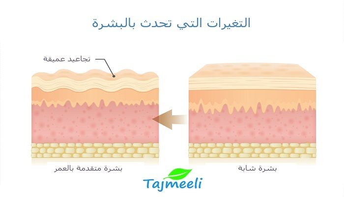 ما هي ترهلات الرقبة