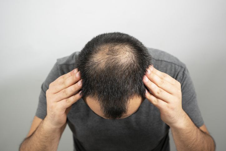 في أي موسم تتم زراعة الشعر؟