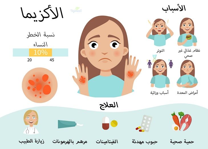 نبذة عن علاج اكزيما الشعر بمصر