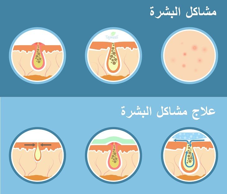 كريم التفتيح السريع من غارنييه لعلاج مشاكل البشرة