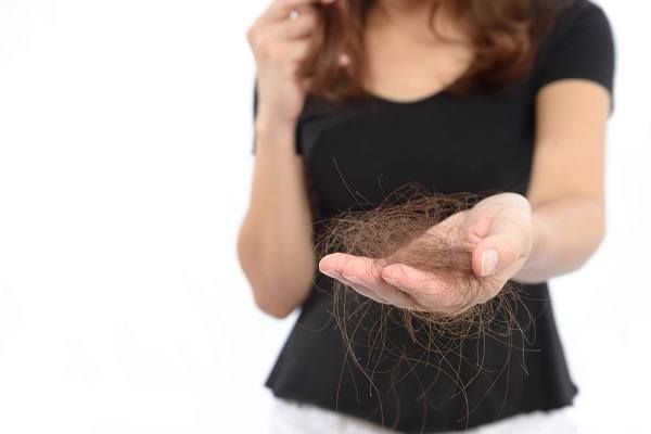 تساقط الشعر بسبب استخدام الكيمياويات