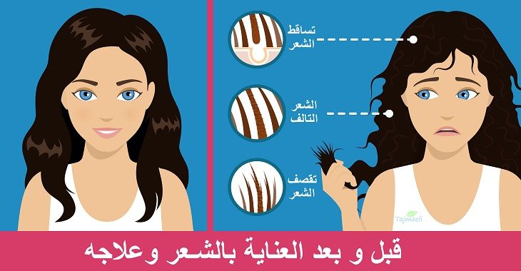 الفرق بين الشعر الصحي والشعر التالف