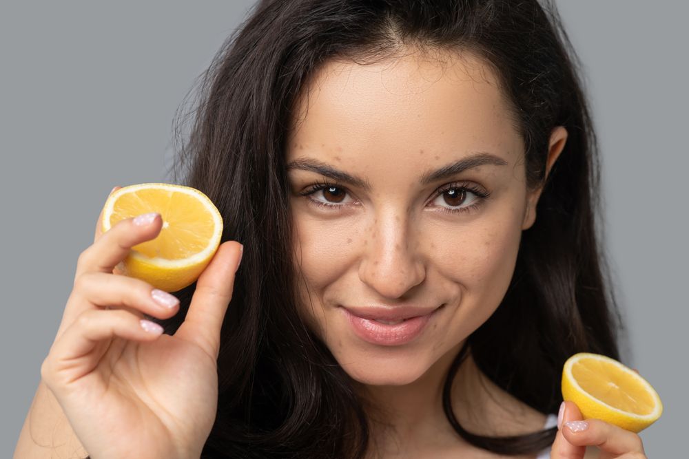 Orange and lemon peel recipe to treat melasma