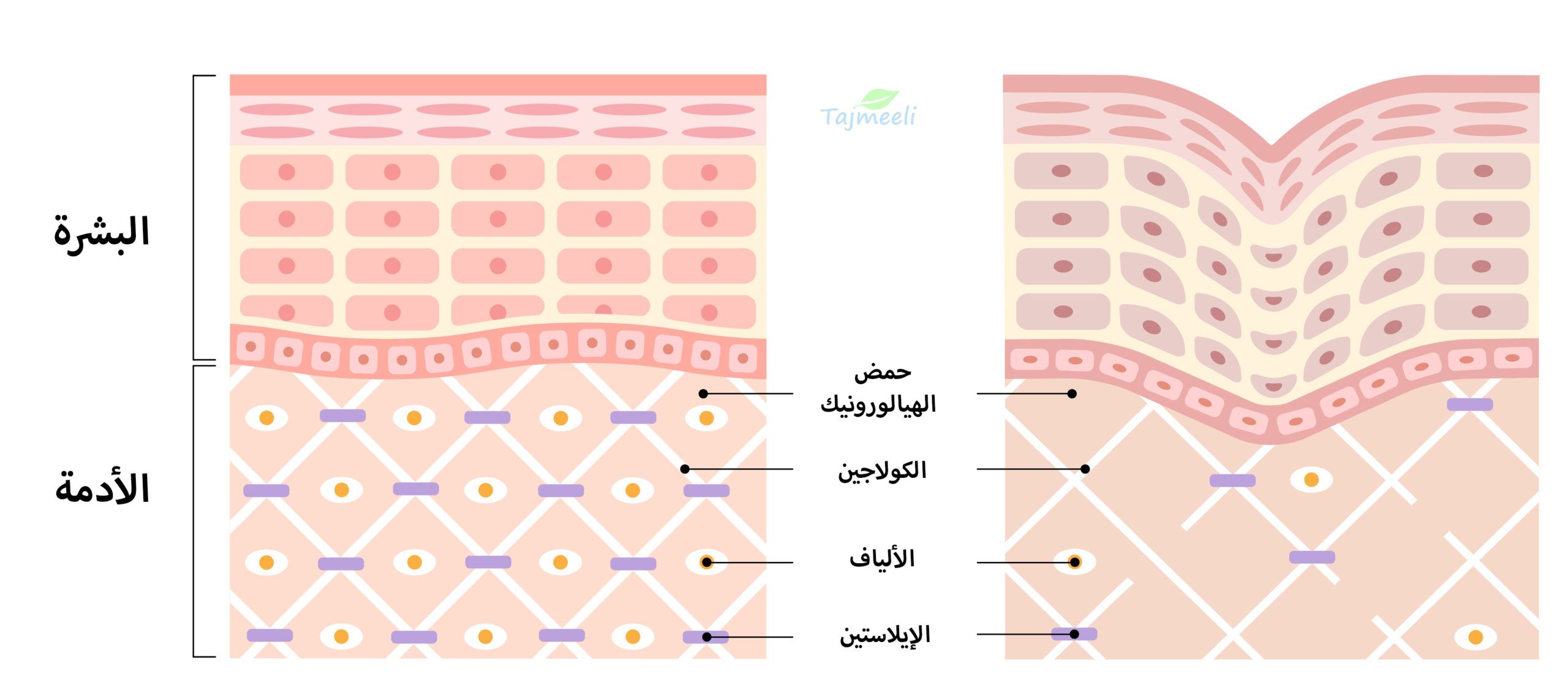 فوائد وأضرار حمض الهيالورونيك للبشره الدهنية