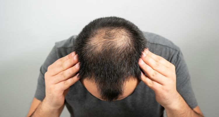 زراعة الشعر بالاقتطاف