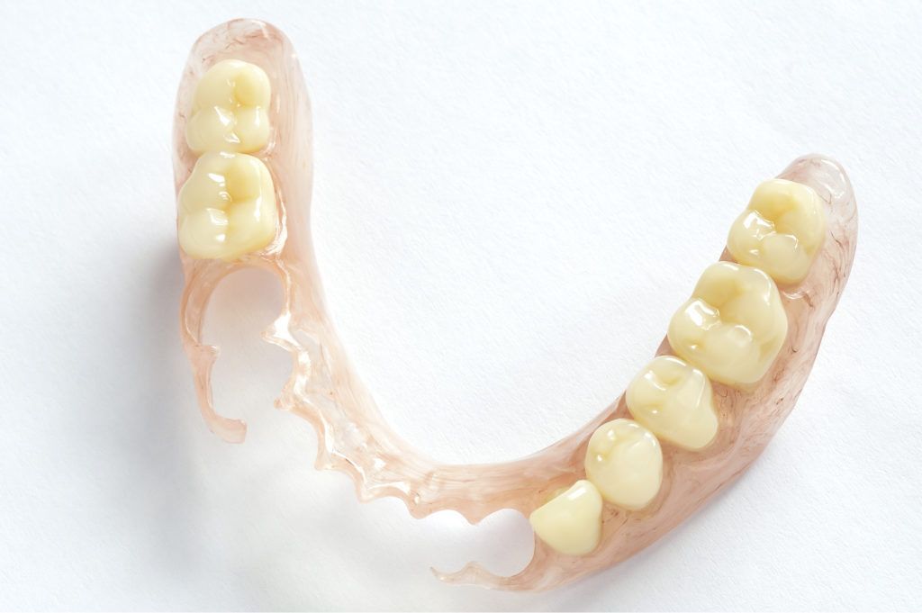 التركيبات الجزئية المتحركة للأسنان