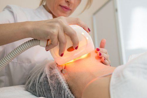 إزالة تجاعيد الوجه بالليزر (Laser Resurfacing)