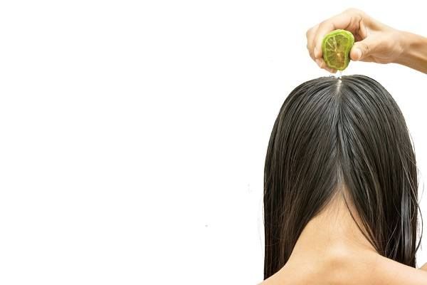 علاج قشرة الشعر بالليمون