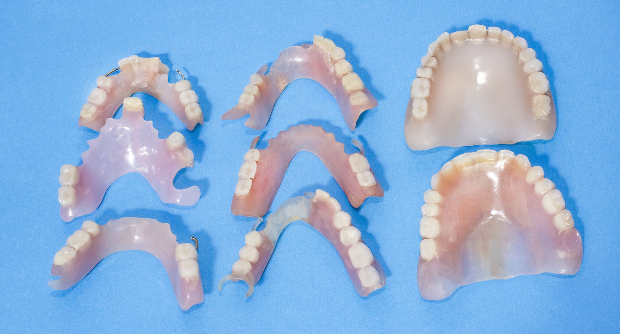 ما هي تركيبات الأسنان المتحركة؟