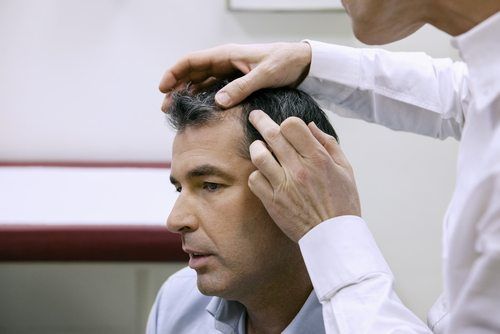 تقنية نيوغرافت لزراعة الشعر