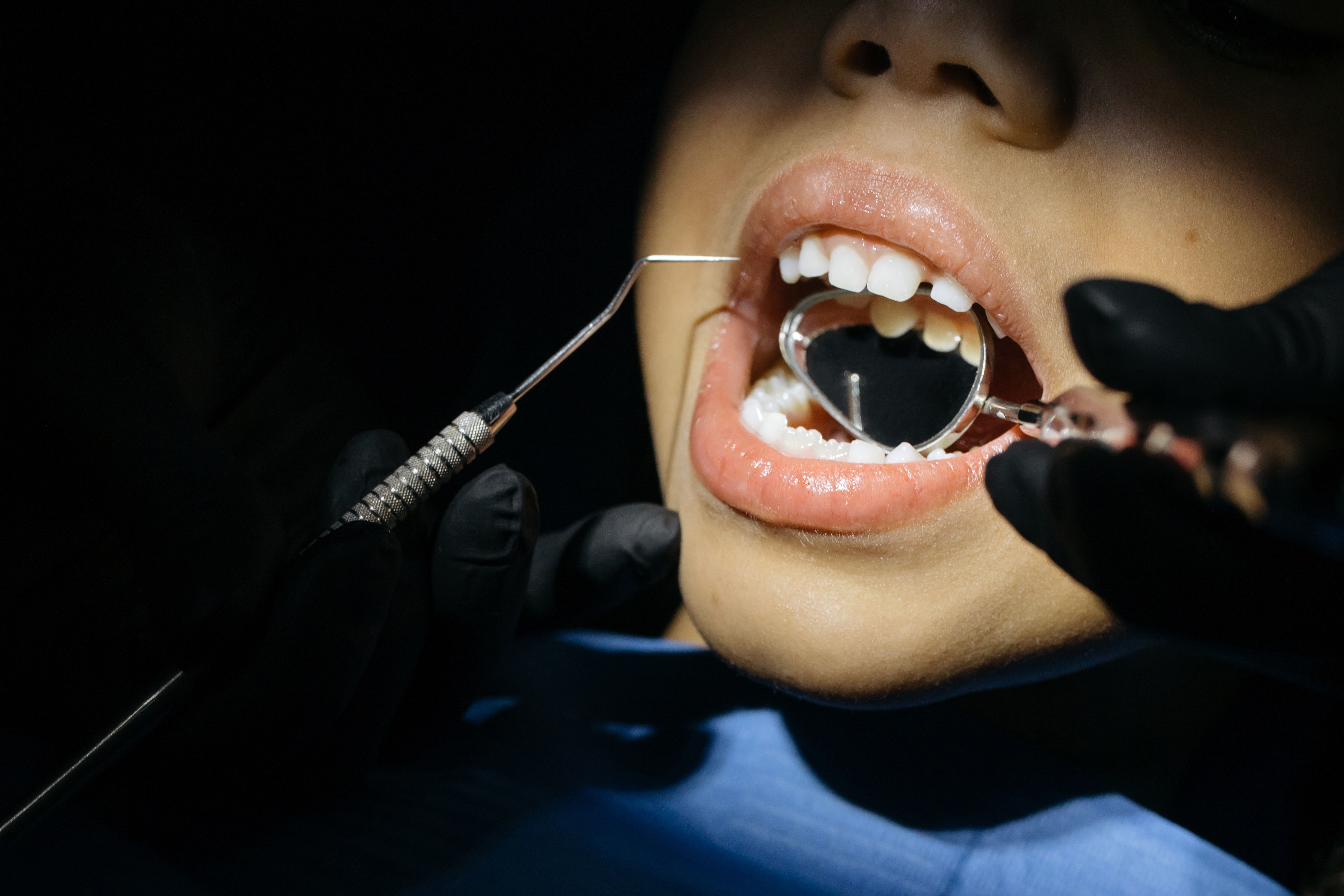 شكل أسنان الأطفال وفحص الأسنان لإجراء التقويم