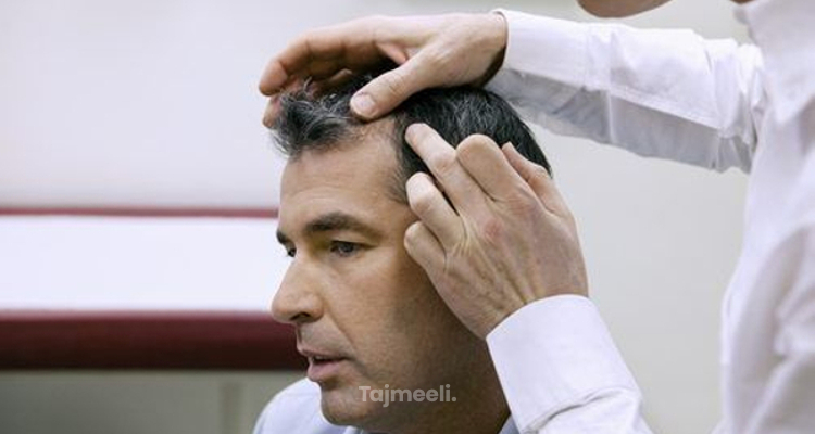 أفضل دكتور زراعة الشعر في اسطنبول