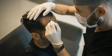 NeoGraft لزراعة الشعر