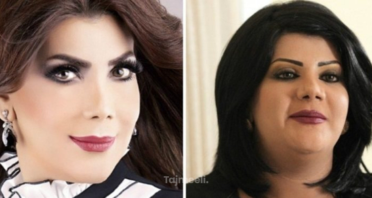 أشهر الفنانات العربيات بعد عمليات التجميل