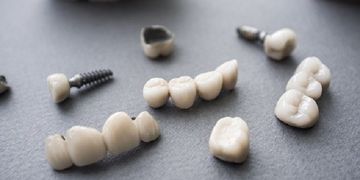 الفرق بين تركيب الأسنان وزراعة الأسنان