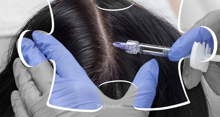 تجربتي مع زراعة الشعر للنساء