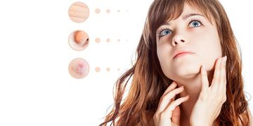 تخلص من مشاكل الجلد والشعر مع 8 من أقوى علاجات الأمراض الجلدية