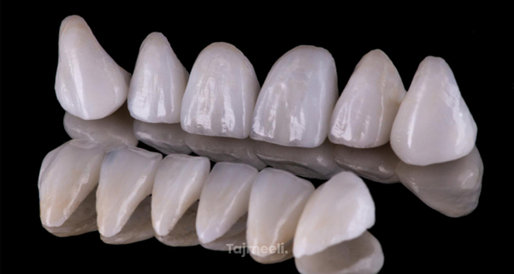 تركيبات الاسنان البورسلين