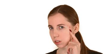 طرق علاج الكيس الدهني في الوجه
