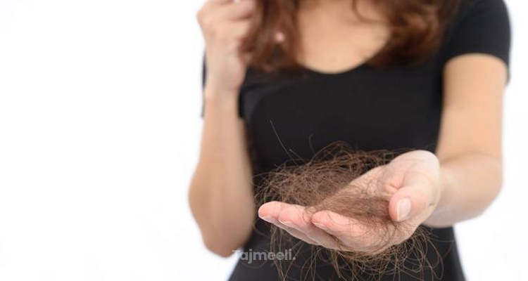علاج الشعر الدهني المتساقط