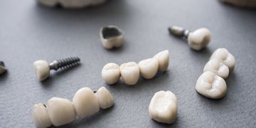عملية تثبيت الاسنان