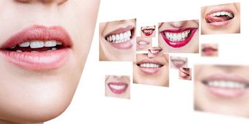 فوائد واضرار تبييض الاسنان بالليزر