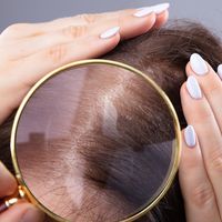 ما هي انواع الشعر؟