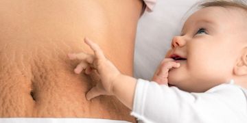 متى تعود البطن لطبيعتها بعد الولادة القيصرية؟