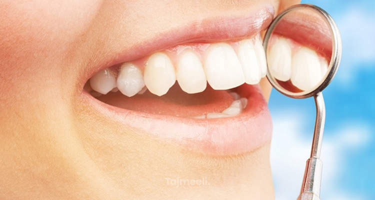 مشكلة البقع البيضاء في الاسنان وطرق علاجها