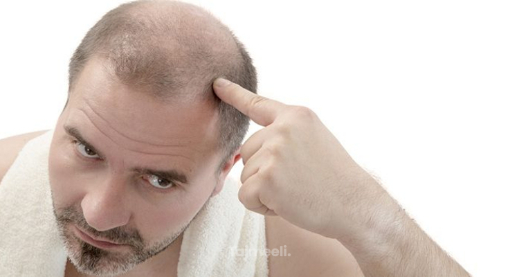 مشكلة تساقط الشعر عند الرجال وأفضل الحلول