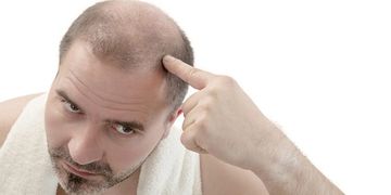 مشكلة تساقط الشعر عند الرجال وأفضل الحلول