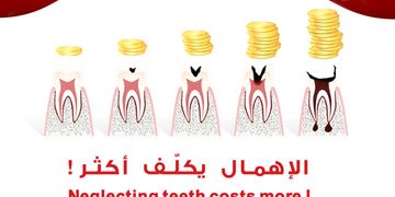 إهمال الأسنان يكلف أكثر مالاً وألماً | حشوات الأسنان قد تكون الحل