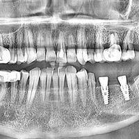 عيادات الاسنان بين القديم والحداثة