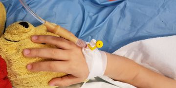 جراحات تجميل الأطفال وعلاج التشوهات