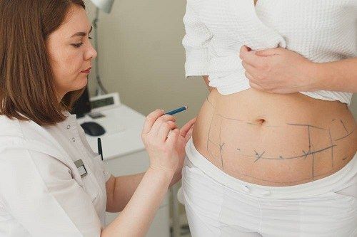 أطباء ومراكز شفط الدهون بدون جراحة في الإمارات