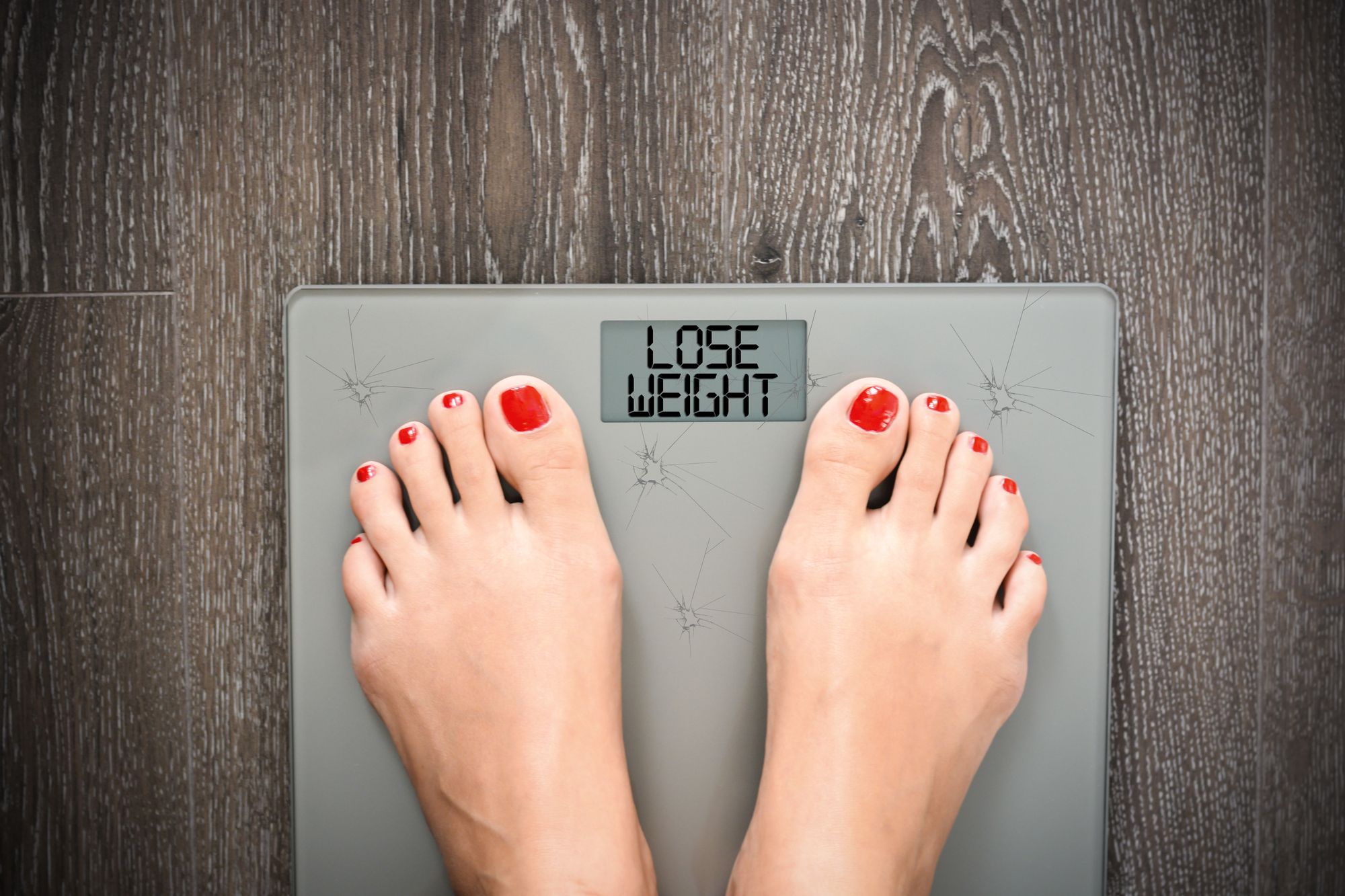 فقدان الوزن الزائد بعد تكميم المعدة