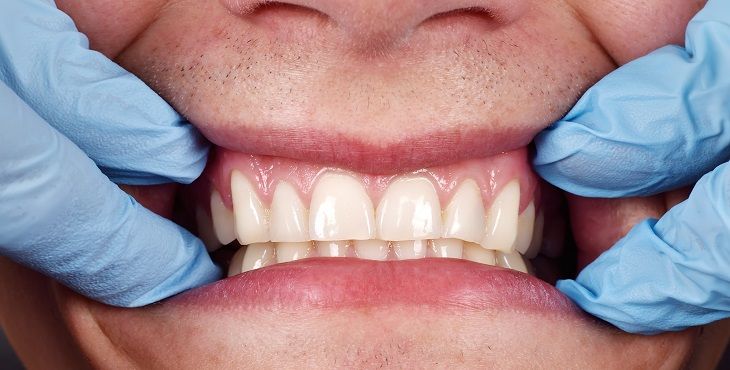مواصفات الأسنان