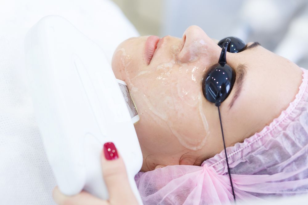 طرق ازالة النمش من الوجه العلاج بالليزر