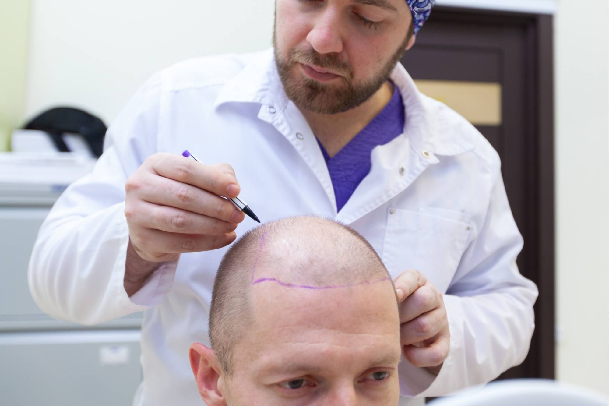 The Best Hair Transplant Centers in Egypt
