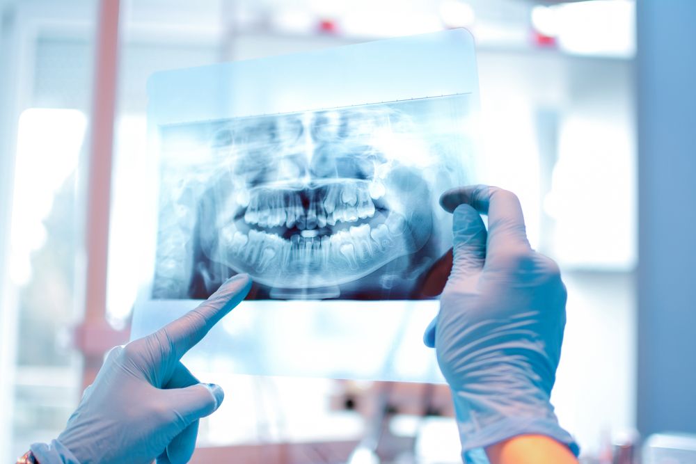 ⁨‎⁨عوامل مؤثرة في تحديد تكلفة زراعة الأسنان في مستشفى الحبيب⁩⁩