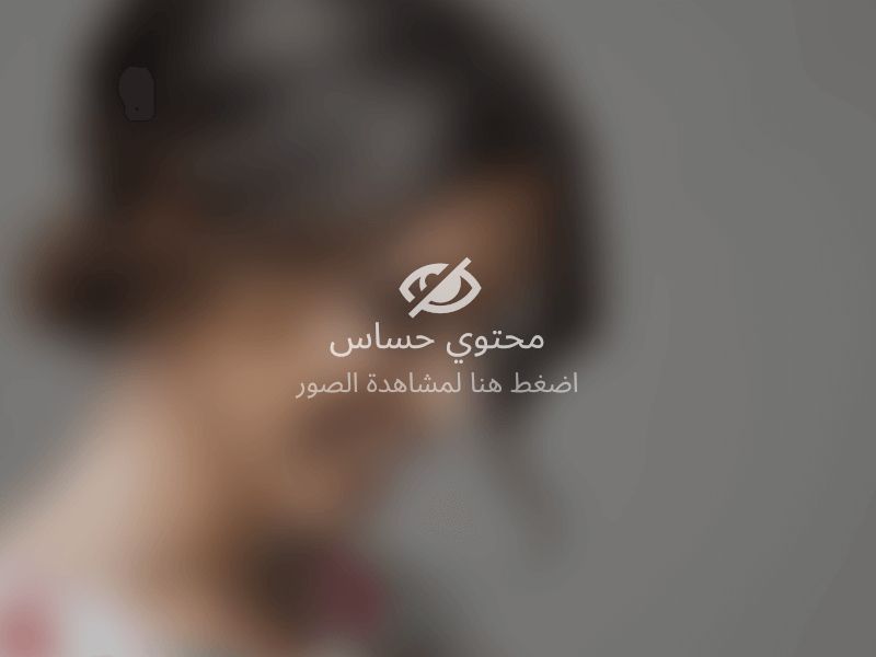 أشهر مراكز أسنان توفر هوليود سمايل في جدة