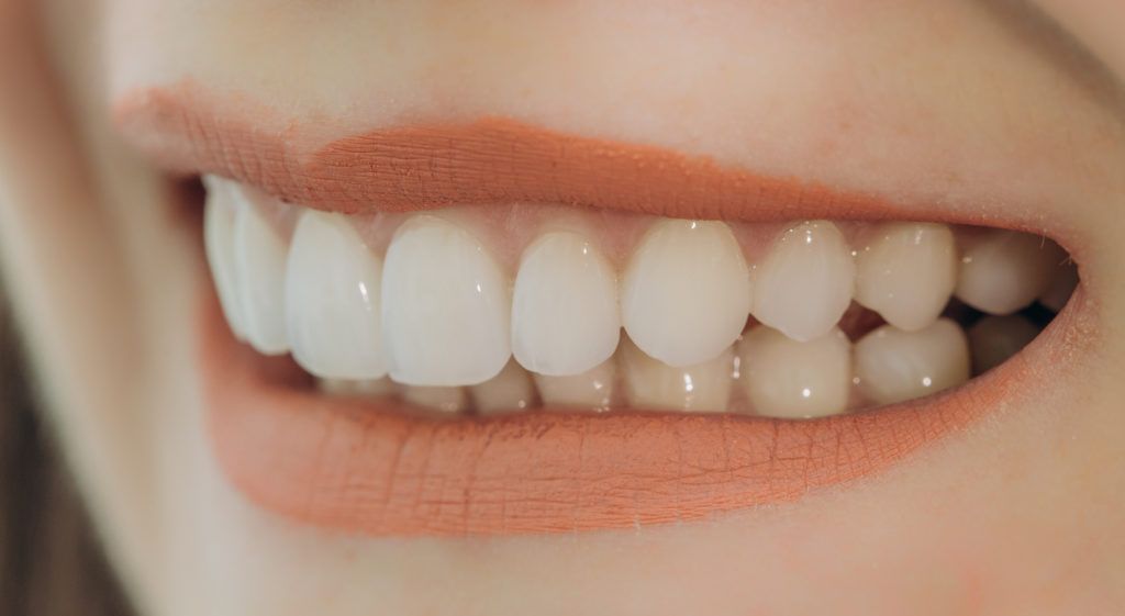 فوائد تركيبات الأسنان الأمامية الثابتة