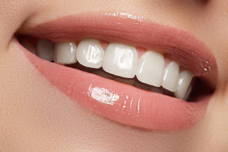 أهمية العناية بنظافة الأسنان