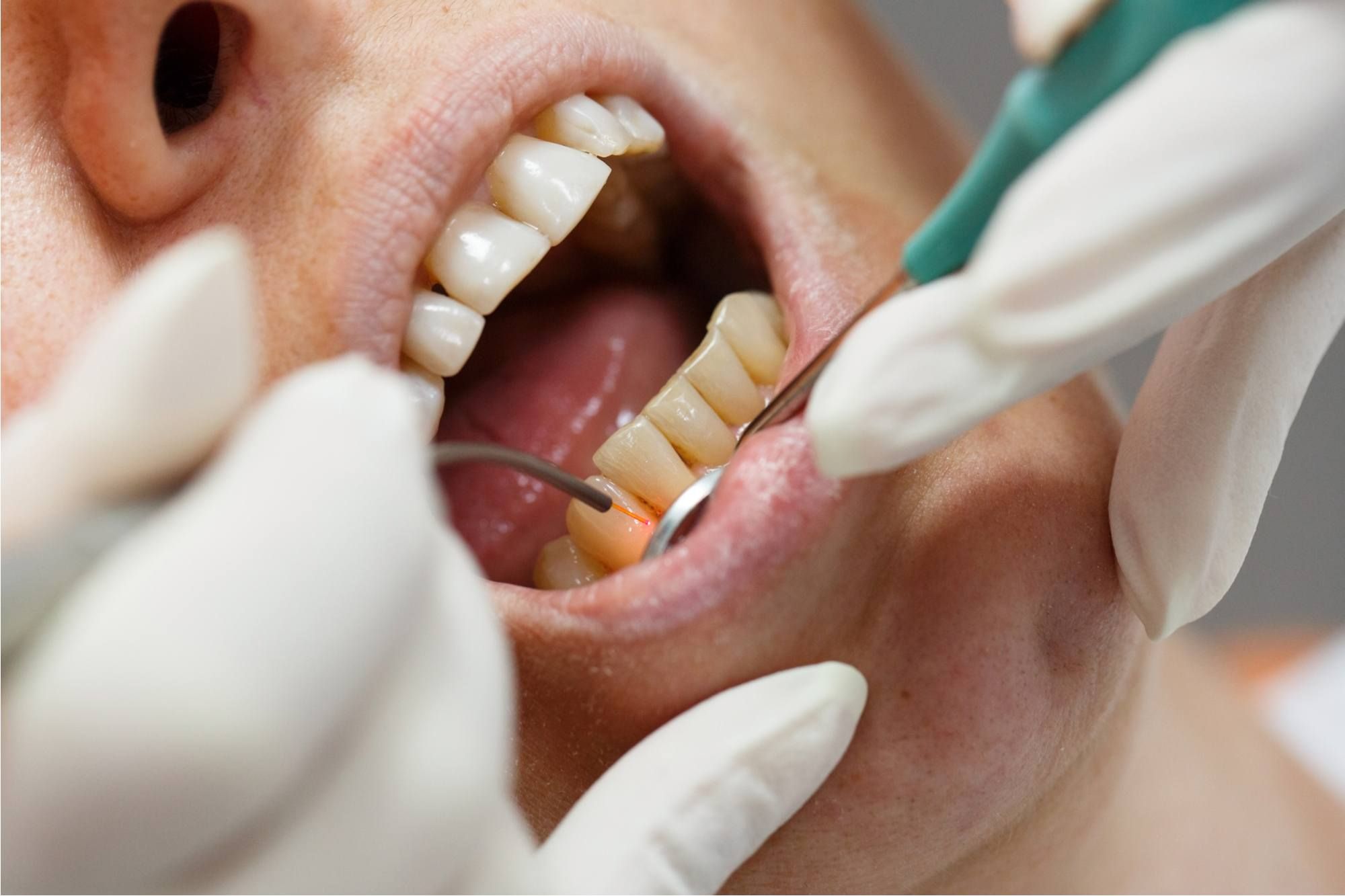 تقنيات تعديل الاسنان في مصر