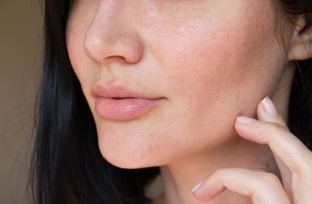 هل هناك آثار جانبية لتطبيق الإبر الذهبية لتجميل الوجه؟